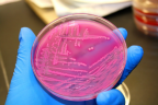 E-coli-propane-2-537x358